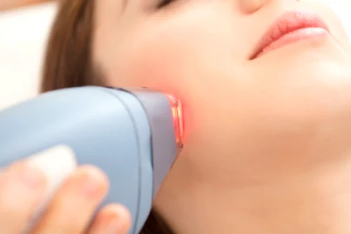 Laser Treatment for Acne, Hair Removal, Skin Rejuvenation, and Genital Rejuvenation