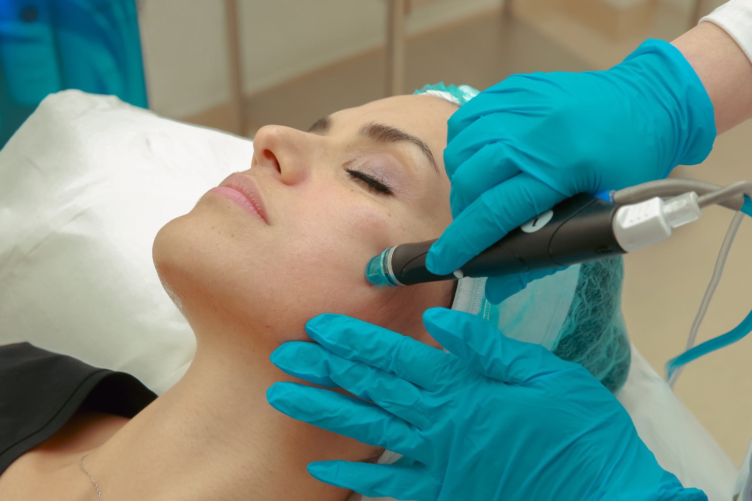 Micro Needling